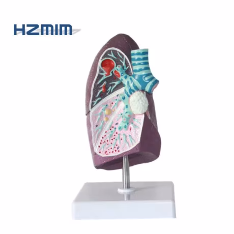Medical science human anatomical Lung Segment Model, human lung model